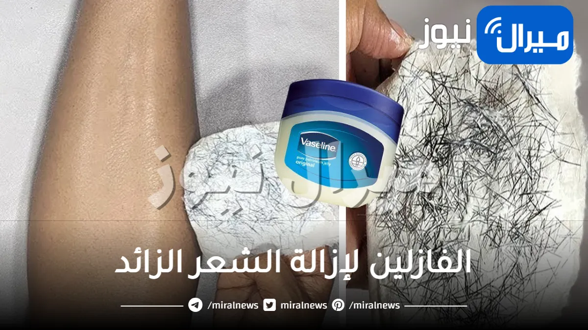 بديل الليزر المعجزة .. وصفة سحرية من الفازلين لإزالة الشعر الزائد نهائيا من الجذور بدون ألم في دقائق معدودة