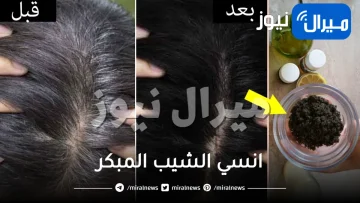 “دون صبغ الشعر”  انسي الشيب المبكر بملعقة واحدة من القرنفل سيختفي من دون عودة نهائيا بهذه الطريقة السحرية