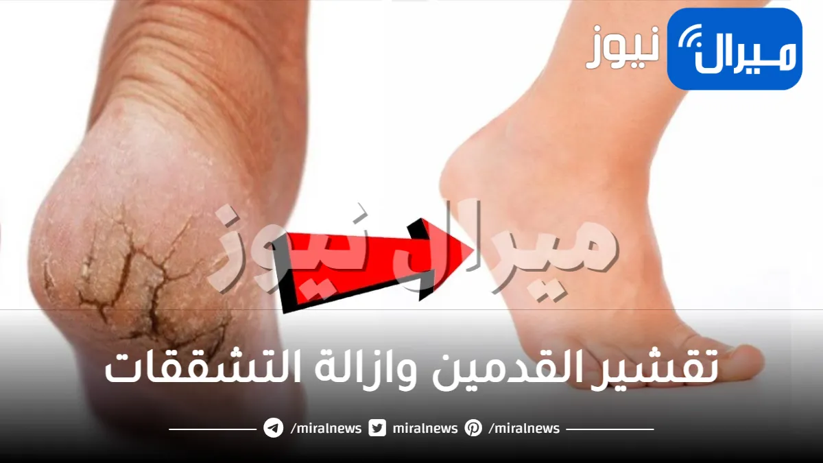 طريقة مميزة لتقشير القدمين وازالة التشققات بطريقة بسيطة وسريعة تجلعها وردية وحرير .. والسر بهذا المكون المعجزة