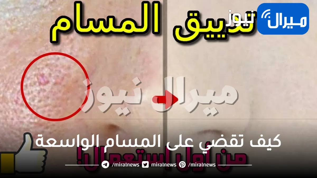 كيف تقضي على المسام الواسعة في بشرتك