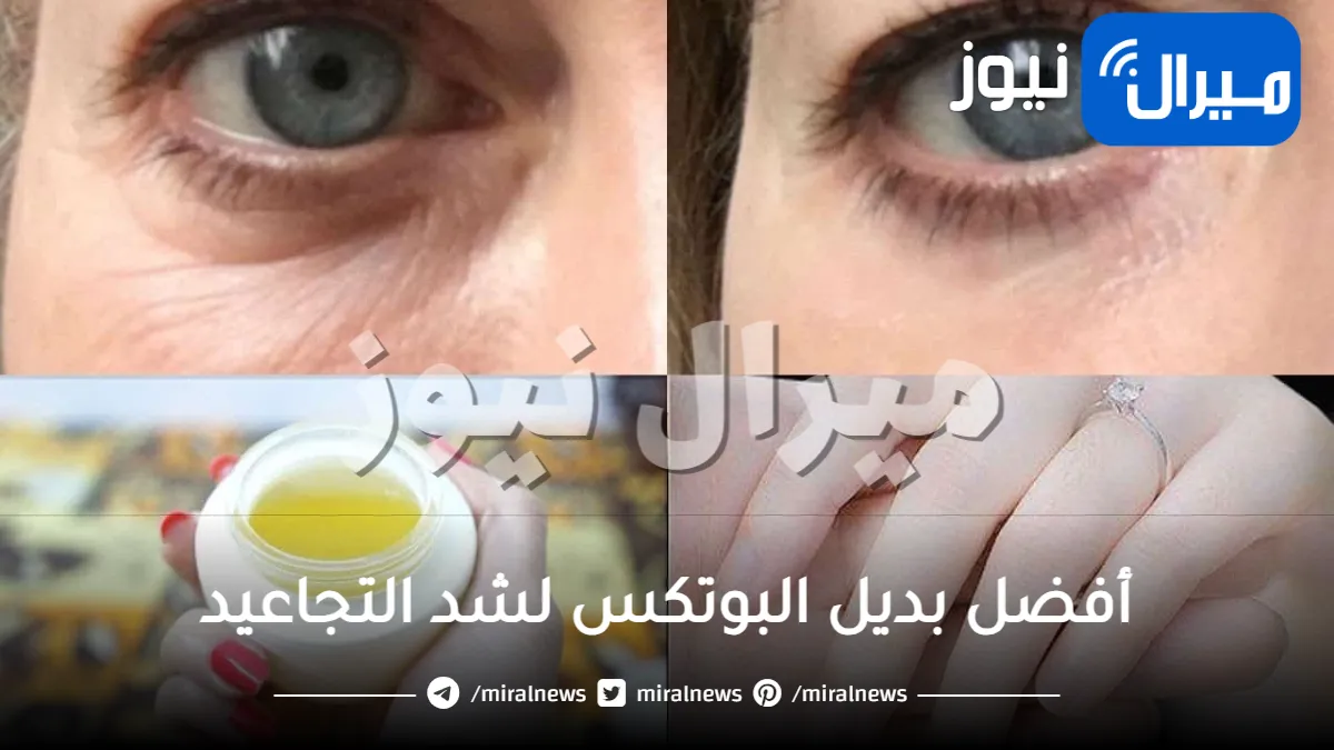 أفضل بديل البوتكس لشد التجاعيد.. مكونات منزلية تجعل بشرتك مشدودة ونقية بسرعة البرق