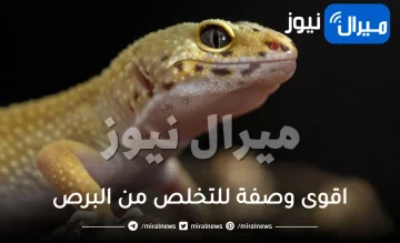 بطريقة نهائية .. اقوى وصفة للتخلص من البرص مجربة 100% .. أعمليها بنفسك وبدون كلفة