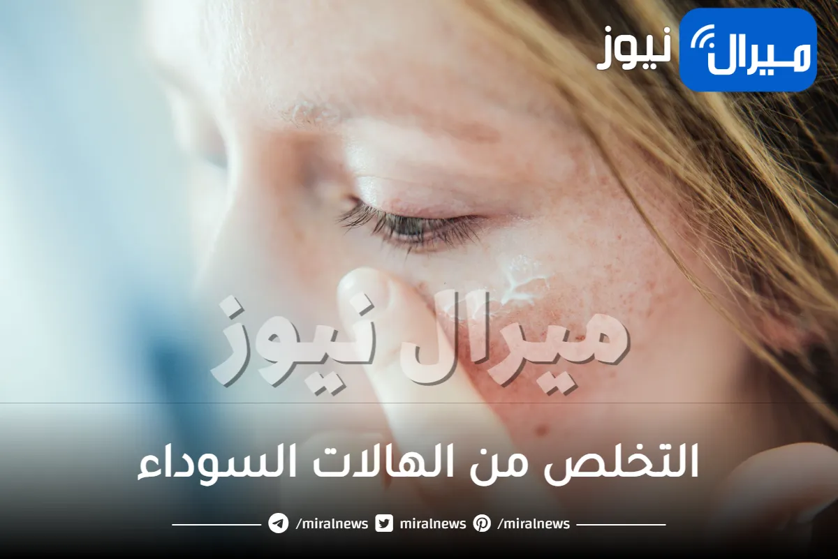 للتخلص من الهالات السوداء نهائياً وتقشير جلد الوجه .. اتبع هذه الخطوات السرية