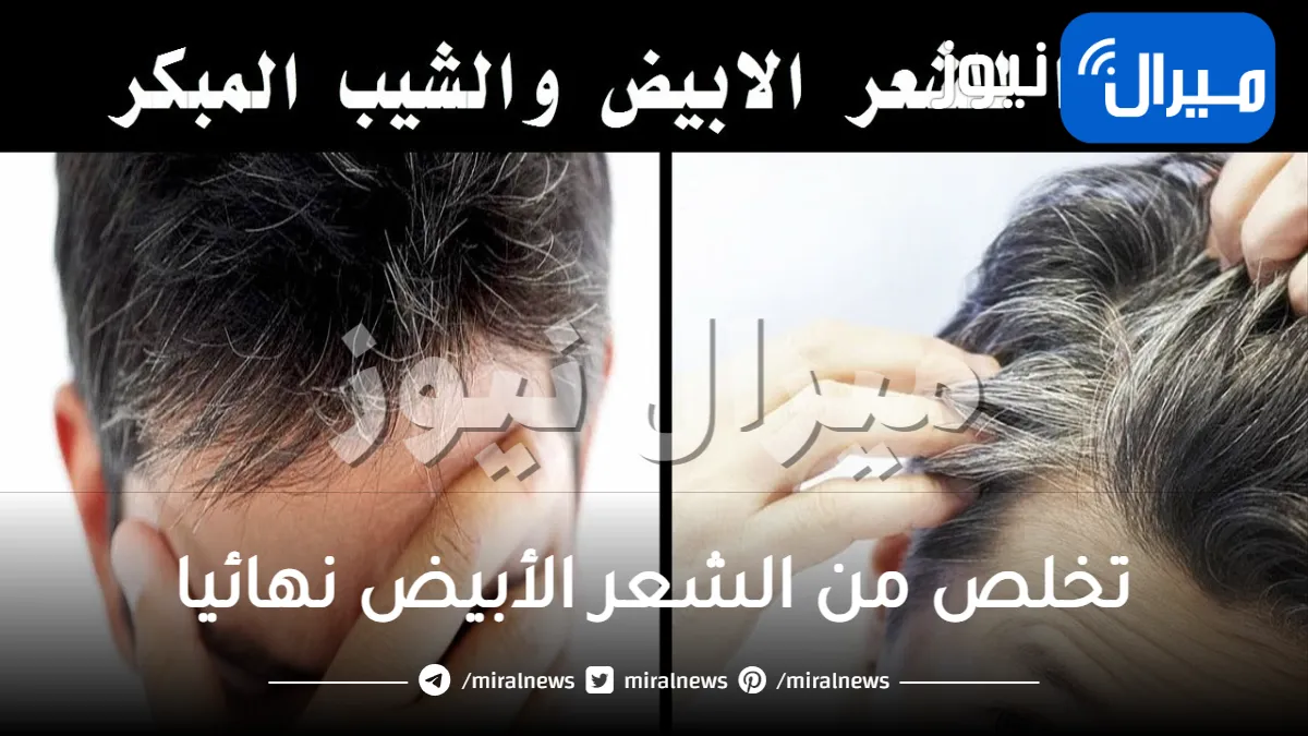 أقوى علاج سحري للشيب بالخميرة للتخلص من الشعر الأبيض نهائيا مهما كان عمرك وبدون صبغ الشعر