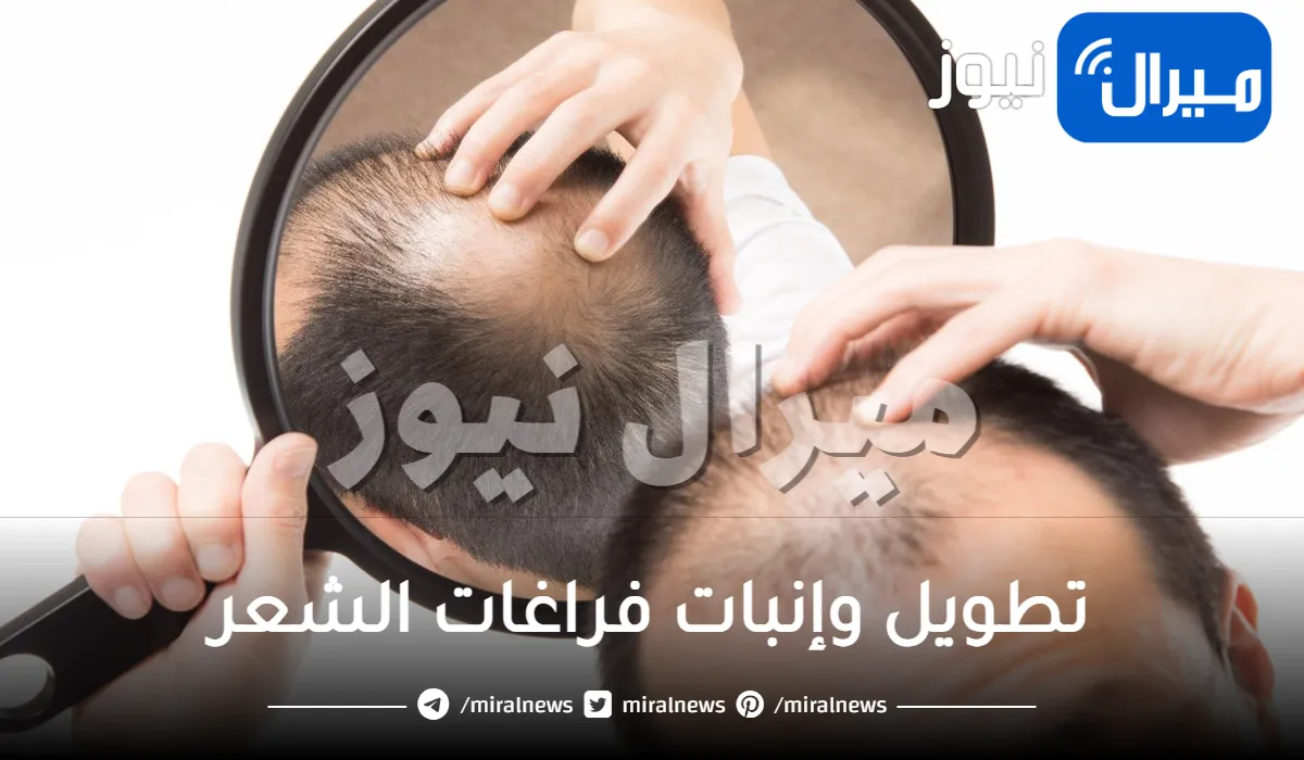 وداعاً للصلع والتساقط .. مكون معجزة لتطويل وإنبات فراغات الشعر ومعالجة الصلع ومنع التساقط في 7 أيام فقط (أسرار التحضير)