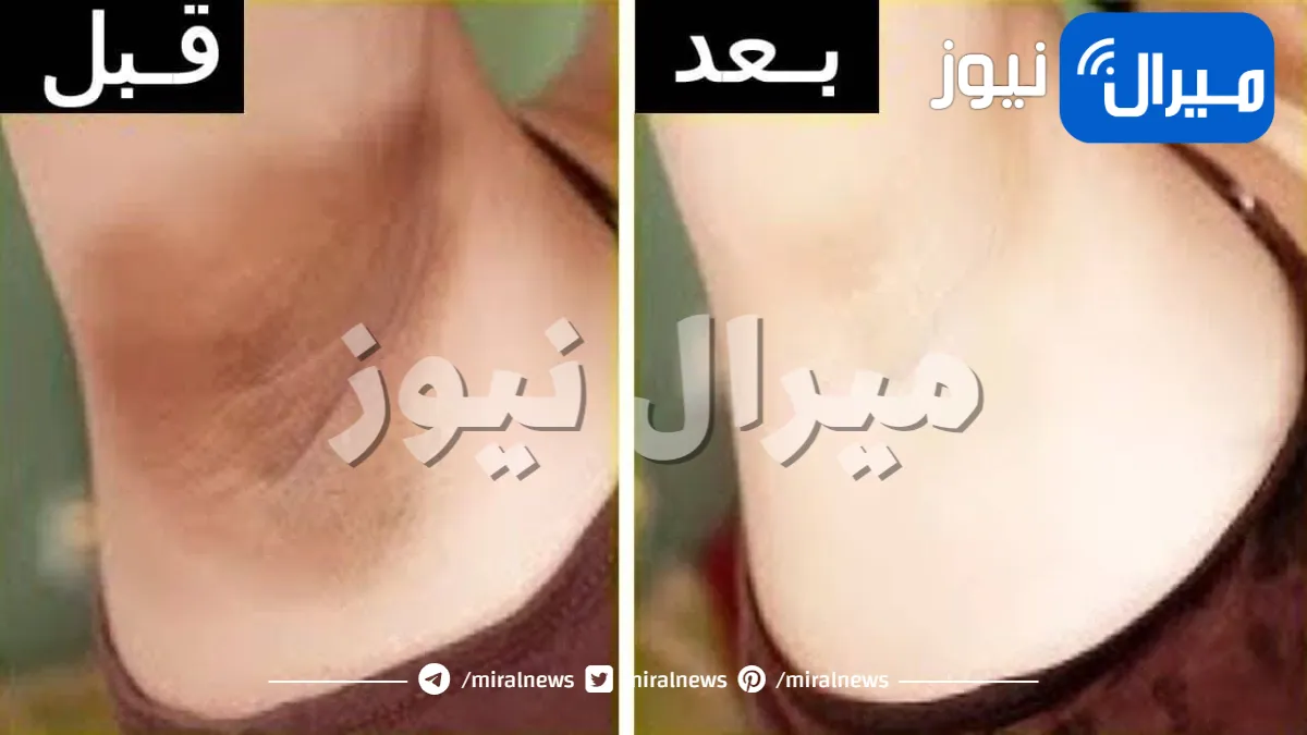 كريم طبيعي جبار لتفتيح وتبييض الأماكن الحساسة بين الفخذين والإبط وإزالة البقع الداكنة من أول مرة