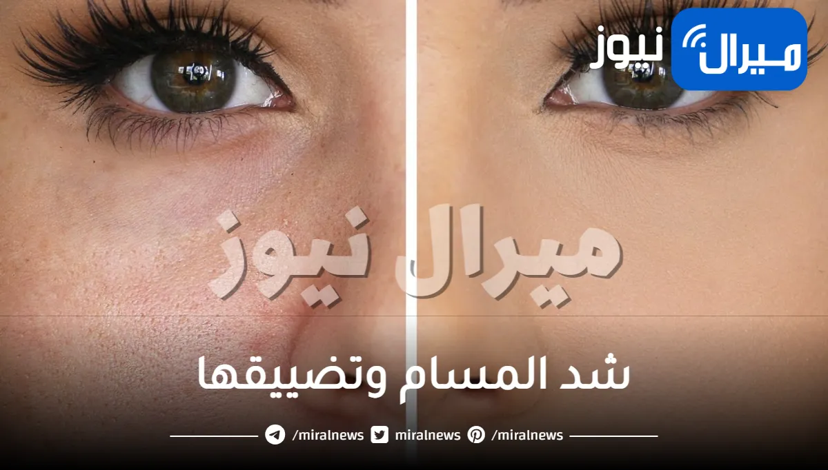 مكونات طبيعية خارقة تعمل على شد المسام وتضييقها بسرعة البرق وتحدي.. متوفرة في كل مطبخ