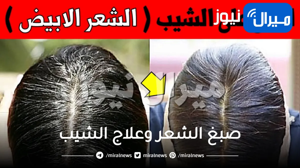 بلون ثابت طوال العمر .. “القرنفل” مع “القهوة” لصبغ الشعر وعلاج الشيب في أقل من 30 دقيقة .. يختفي الشيب للأبد اذا استخدمته بهذه الطريقة