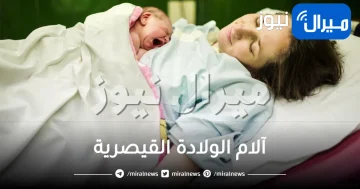 تعرفي على آلام الولادة القيصرية