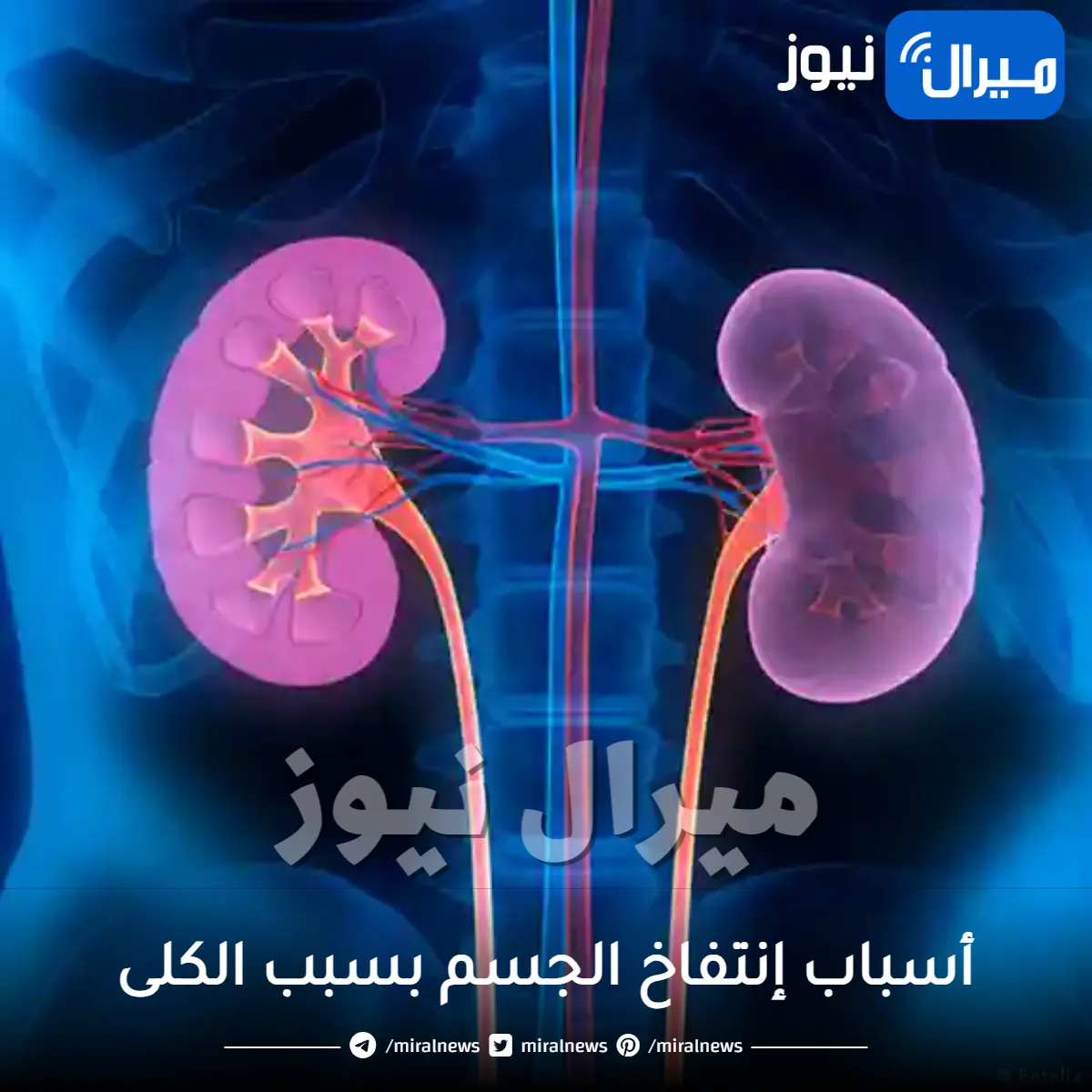 أسباب إنتفاخ الجسم بسبب الكلى
