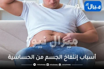 أسباب إنتفاخ الجسم من الحساسية