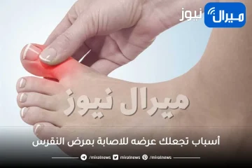أسباب تجعلك عرضه للاصابة بمرض النقرس