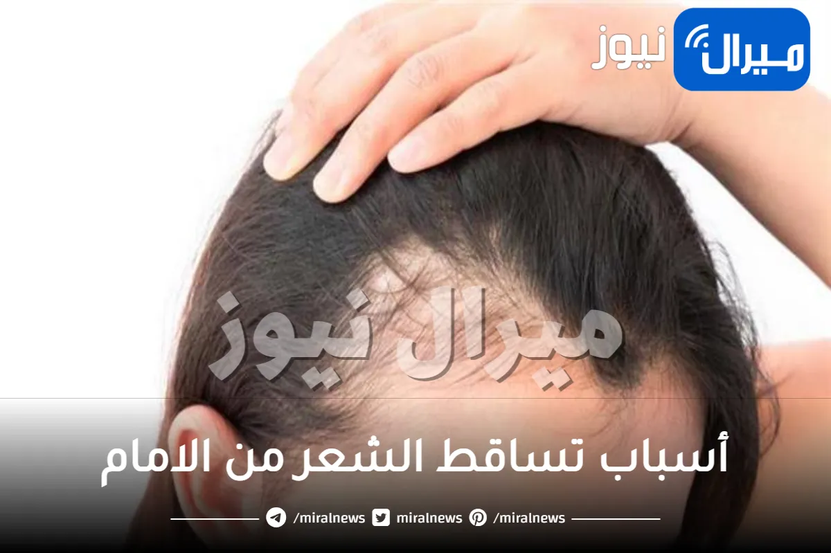 أسباب تساقط الشعر من الامام