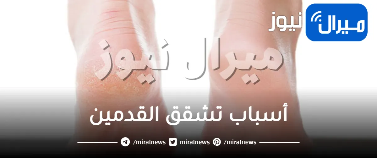 أسباب تشقق القدمين وطرق علاجه