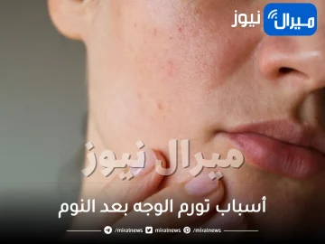 ما أسباب تورم الوجه بعد النوم؟