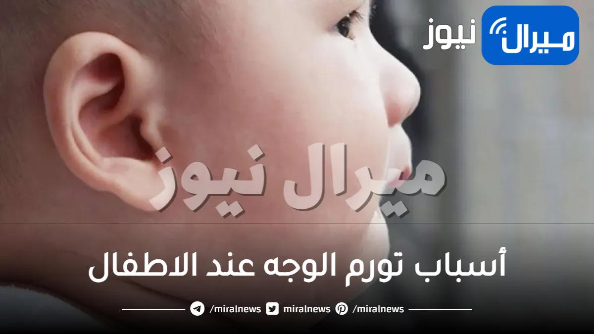 أسباب تورم الوجه عند الاطفال