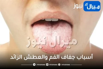 أسباب جفاف الفم والعطش الزائد