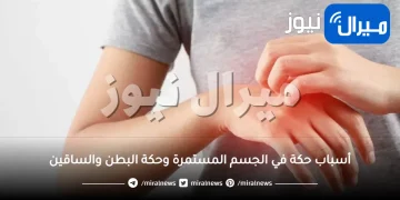 أسباب حكة في الجسم المستمرة وحكة البطن والساقين