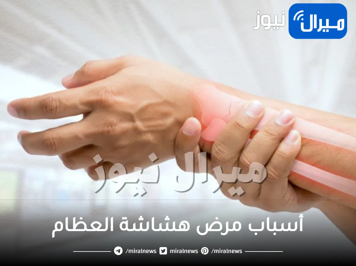 أسباب مرض هشاشة العظام وكيف يتم علاجه