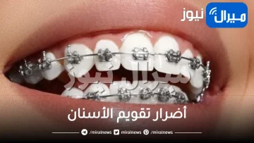 أضرار تقويم الأسنان على المدى البعيد .. عملية تصليح الأسنان وتنظيمها