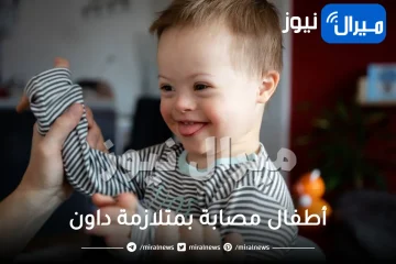 ولادة أطفال مصابة بمتلازمة داون.. اعرفي الأسباب وتجنبيها