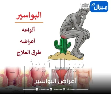 أعراض البواسير..أسباب الإصابة بها وطرق علاجها