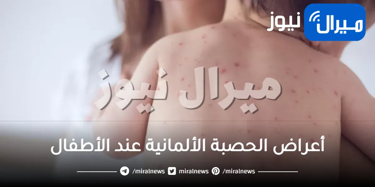 أعراض الحصبة الألمانية عند الأطفال ومضاعفتها .. ونصائح للوقاية منها