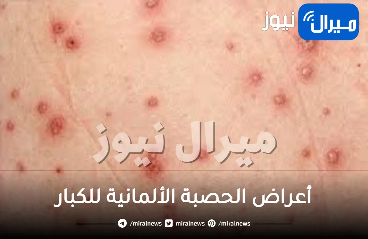 أعراض الحصبة الألمانية للكبار .. ارتفاع الحرارة وصعوبة البلع أبرزها