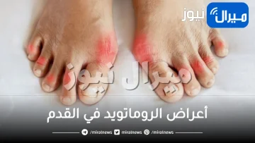 أعراض الروماتويد في القدم .. ماهي أسباب وأعراض الروماتويد في القدمين
