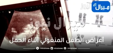 أعراض الطفل المنغولي أثناء الحمل