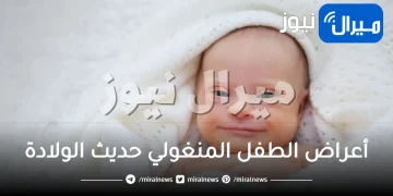 أعراض الطفل المنغولي حديث الولادة وطرق التعامل معه