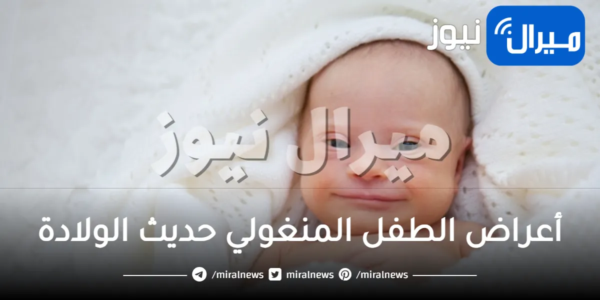أعراض الطفل المنغولي حديث الولادة وطرق التعامل معه