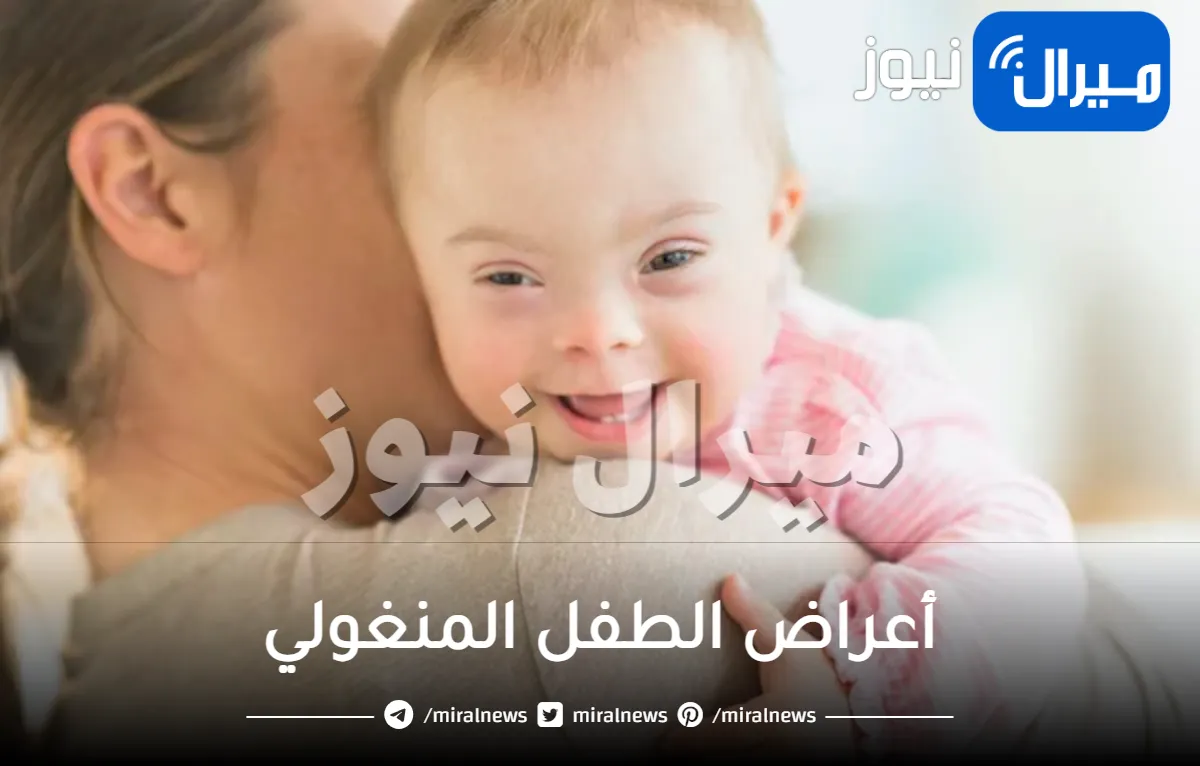 أعراض الطفل المنغولي وكيفية التعامل معه لتقديم الدعم