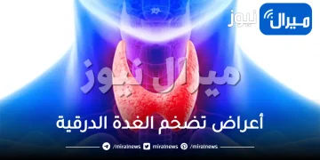 أعراض تضخم الغدة الدرقية .. أسباب تضخم الغدة الدرقية وأعراضها وعلاجها