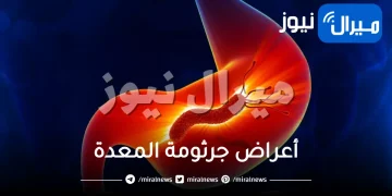 أعراض جرثومة المعدة