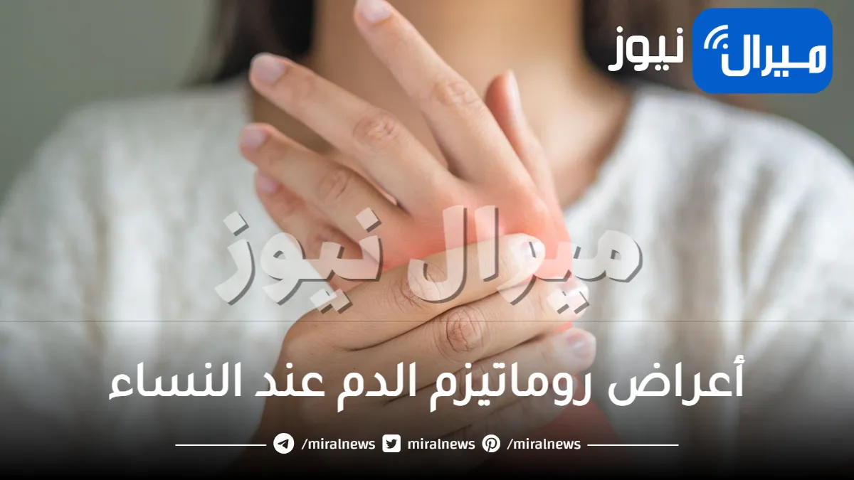 تعرفي على أعراض روماتيزم الدم عند النساء وأهم طرق العلاج