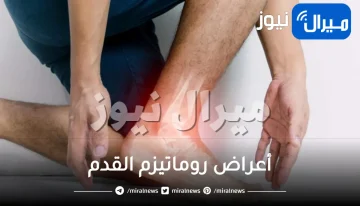 أعراض روماتيزم القدم .. أبرز أعراض روماتيزم القدمين وطرق علاجه