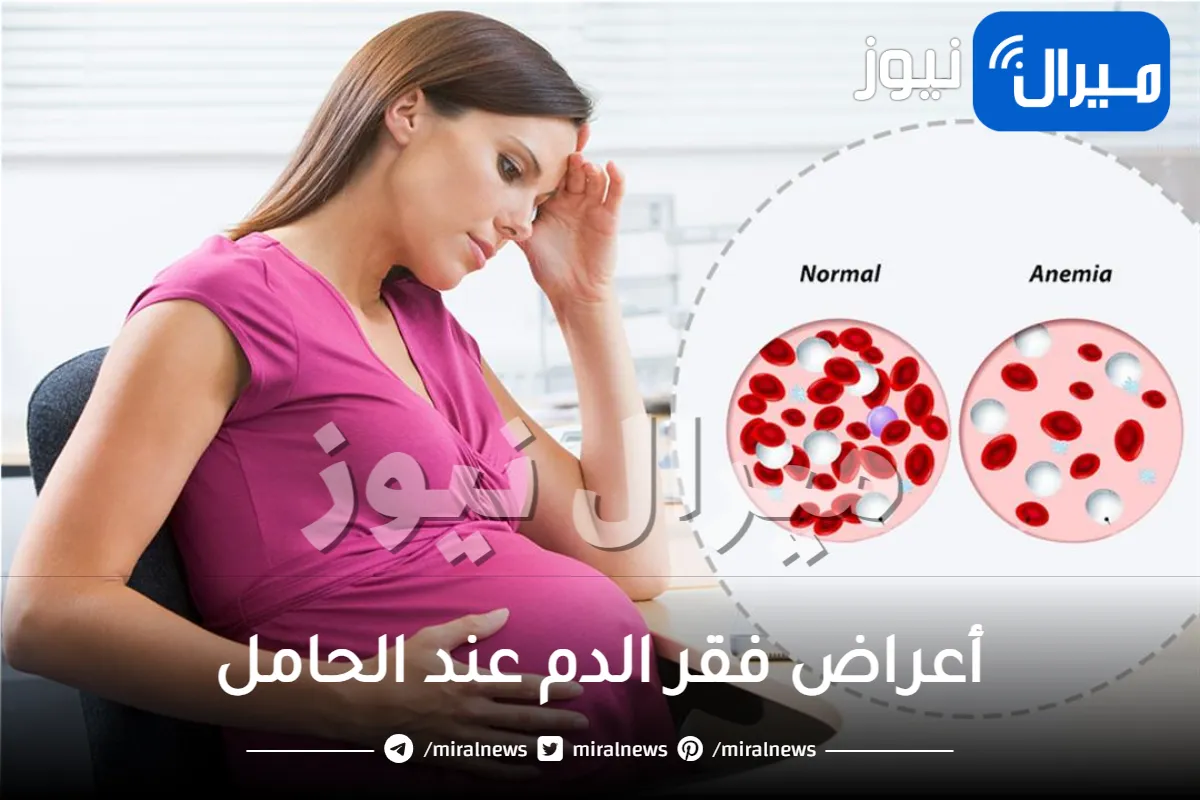 أعراض فقر الدم عند الحامل