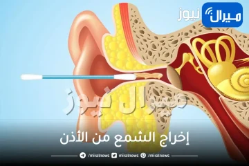 بدقيقة واحدة .. طريقة سحرية لإخراج الشمع من الأذن بكل سهولة وبدون ألم