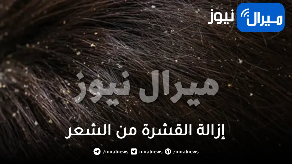 إزالة القشرة من الشعر بوصفات طبيعية