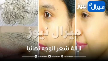 أبرز طرق ازالة شعر الوجه نهائيا بوصفات طبيعية