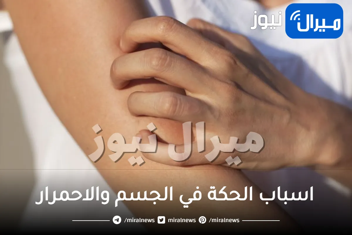 اسباب الحكة في الجسم والاحمرار