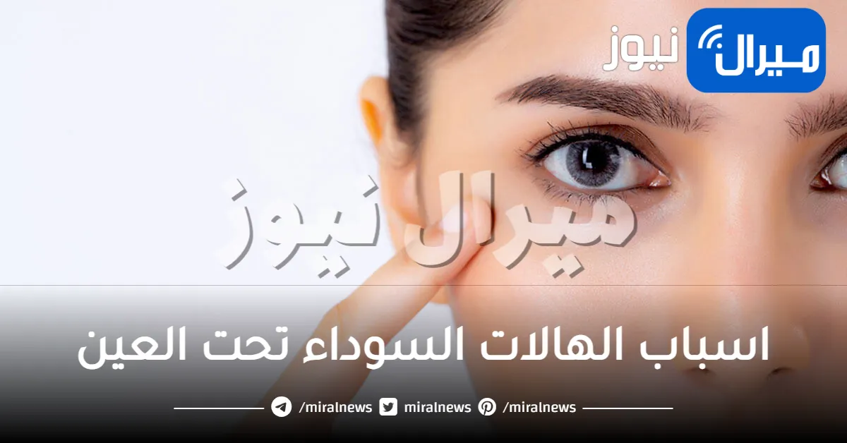 اسباب الهالات السوداء تحت العين .. تعرفي على أبرز الأسباب