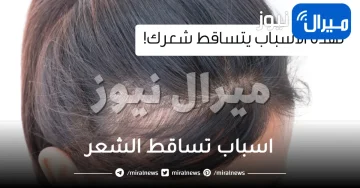 تعرفي على اشهر اسباب تساقط الشعر وطرق العلاج