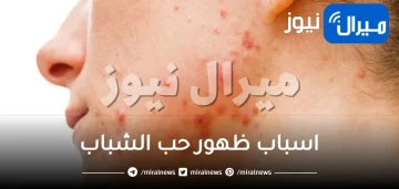 اسباب ظهور حب الشباب .. وانواعه وطرق الوقاية الممكنة