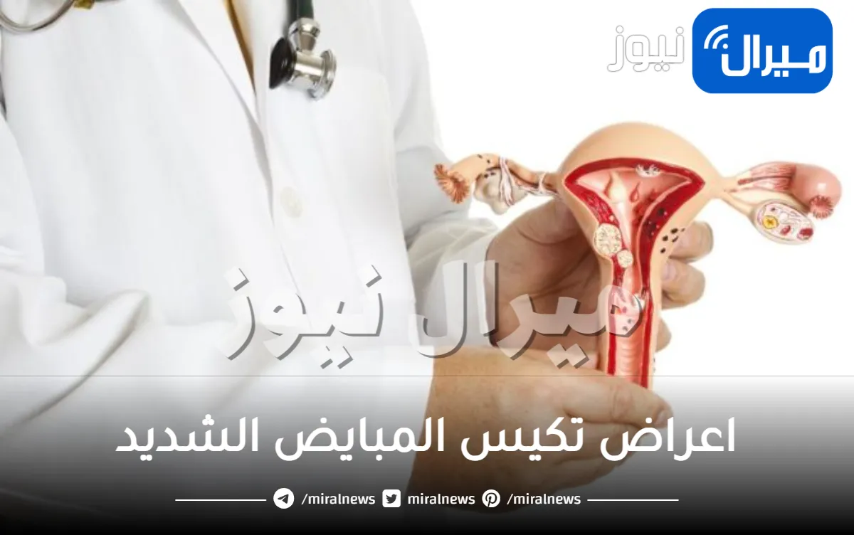 ما هي اعراض تكيس المبايض الشديد وكيف تتعاملي معه