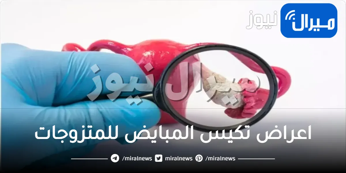 اعراض تكيس المبايض للمتزوجات .. تعرفي عليها
