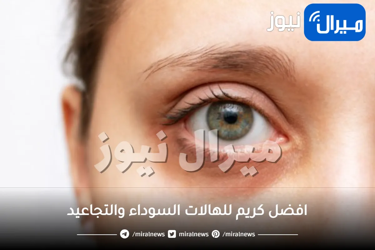 افضل كريم للهالات السوداء والتجاعيد .. تعرفي على أشهرهم