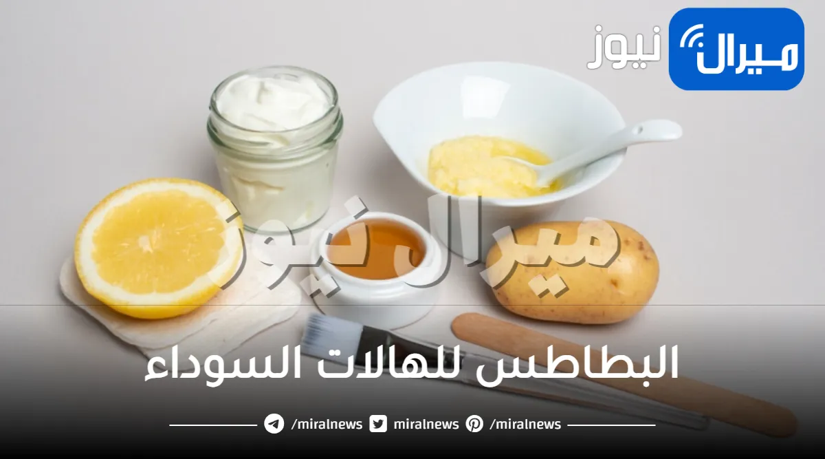 البطاطس للهالات السوداء .. تعرفي على طرق استخدامها في الماسكات