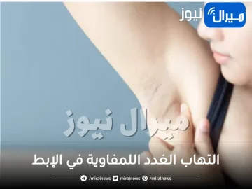 التهاب الغدد اللمفاوية في الإبط .. الاعراض وطرق العلاج